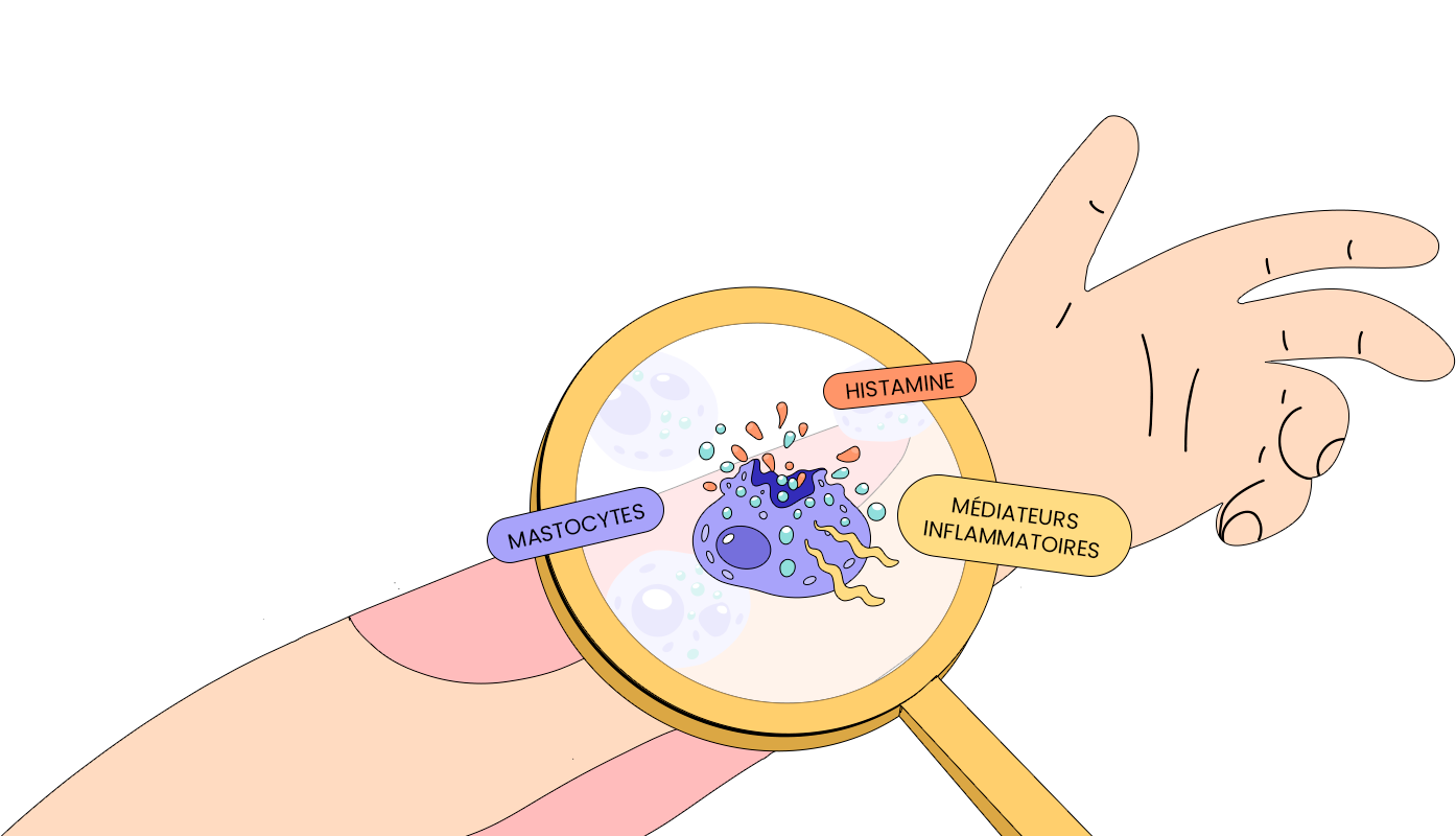 Maladies mastocytaires